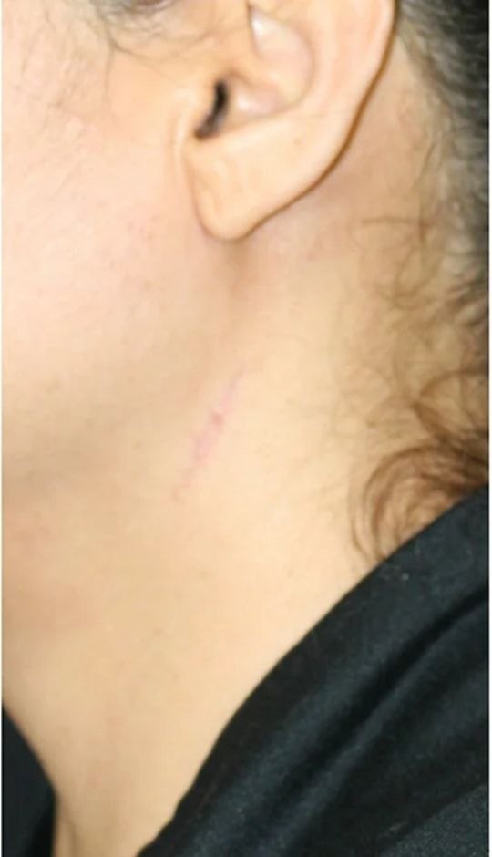 Before treatment result